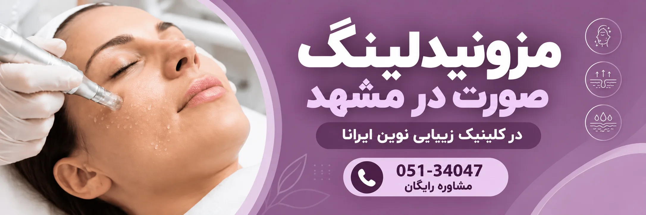 مزونیدلینگ صورت در کلینیک نوین ایرانا
